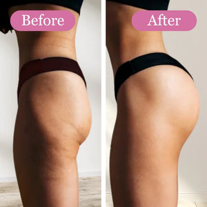 BioLiqs™ Anti-Cellulite Massage Oil